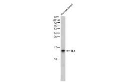 Anti-IL4 antibody [GT1225] used in Western Blot (WB). GTX02822