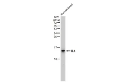 Anti-IL4 antibody [GT1225] used in Western Blot (WB). GTX02822