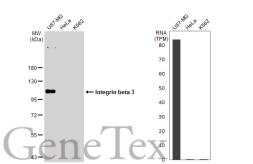 Anti-Integrin beta 3 antibody [GT1226] used in Western Blot (WB). GTX02823