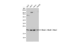 Anti-RhoA + RhoB + RhoC antibody [GT1228] used in Western Blot (WB). GTX02825