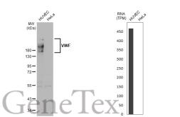 Anti-VWF antibody [GT1230] used in Western Blot (WB). GTX02827
