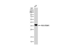 Anti-HLA-DQA1 antibody [GT1231] used in Western Blot (WB). GTX02828