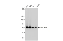 Anti-PKC delta antibody [GT1232] used in Western Blot (WB). GTX02829
