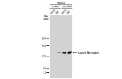 Anti-Leptin Receptor antibody [GT1233] used in Western Blot (WB). GTX02830