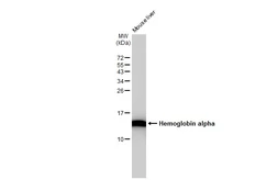 Anti-Hemoglobin alpha antibody [GT1234] used in Western Blot (WB). GTX02831