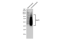 Anti-GluT1 antibody [GT1235] used in Western Blot (WB). GTX02832