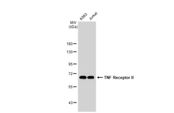 Anti-TNF Receptor II antibody [GT1237] used in Western Blot (WB). GTX02834