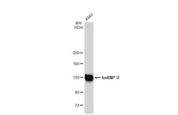 Anti-hnRNP U antibody [GT1242] used in Western Blot (WB). GTX02839