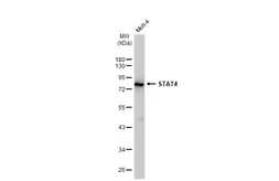 Anti-STAT4 antibody [GT1244] used in Western Blot (WB). GTX02841