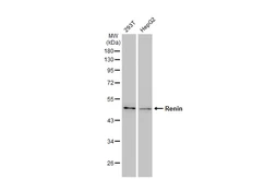 Anti-Renin antibody [GT1245] used in Western Blot (WB). GTX02842