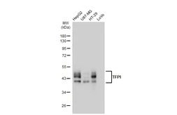 Anti-TFPI antibody [GT1246] used in Western Blot (WB). GTX02843