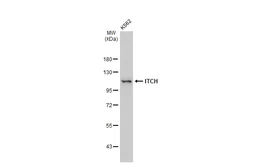 Anti-ITCH antibody [GT1248] used in Western Blot (WB). GTX02845