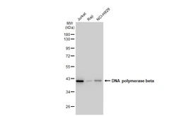 Anti-DNA polymerase beta antibody [GT1251] used in Western Blot (WB). GTX02848