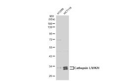 Anti-Cathepsin L/V/K/H antibody [GT1252] used in Western Blot (WB). GTX02849