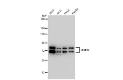 Anti-DDX17 antibody [GT1254] used in Western Blot (WB). GTX02851