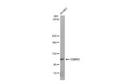 Anti-CDH13 antibody [GT1255] used in Western Blot (WB). GTX02852