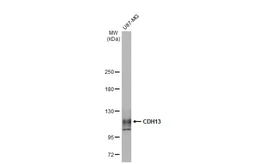 Anti-CDH13 antibody [GT1255] used in Western Blot (WB). GTX02852