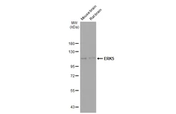 Anti-ERK5 antibody [GT1258] used in Western Blot (WB). GTX02855