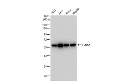 Anti-PAK2 antibody [GT1259] used in Western Blot (WB). GTX02856