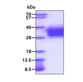 Human Folate Receptor beta protein, His tag. GTX02865-pro
