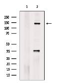 Anti-c-Met (phospho Tyr1234) antibody used in Western Blot (WB). GTX02868