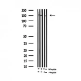 Anti-c-Met (phospho Tyr1234) antibody used in Western Blot (WB). GTX02868