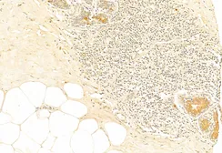 Anti-NRF2 (phospho Ser40) antibody used in IHC (Paraffin sections) (IHC-P). GTX02873