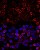 Anti-HDAC6 antibody used in Immunocytochemistry/ Immunofluorescence (ICC/IF). GTX02885