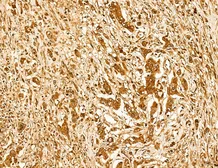 Anti-LASS2 antibody used in IHC (Paraffin sections) (IHC-P). GTX02887