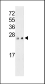 Anti-PTP4A3 antibody used in Western Blot (WB). GTX02889