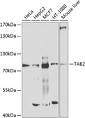 Anti-TAB2 antibody used in Western Blot (WB). GTX02890