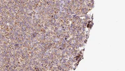 Anti-ASBT antibody used in IHC (Paraffin sections) (IHC-P). GTX03115