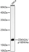 Anti-CDKN2A / p16INK4a antibody used in Western Blot (WB). GTX03119
