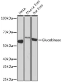 Anti-Glucokinase antibody [GT1266] used in Western Blot (WB). GTX03171