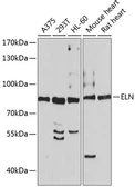 Anti-Elastin antibody used in Western Blot (WB). GTX03178