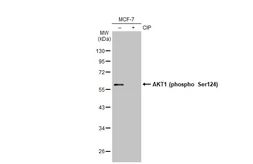 Anti-AKT1 (phospho Ser124) antibody [GT1268] used in Western Blot (WB). GTX03180