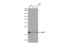 Anti-ARF1 antibody [GT1269] used in Western Blot (WB). GTX03181