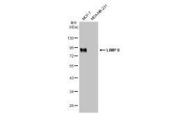 Anti-LIMP II antibody [GT1270] used in Western Blot (WB). GTX03182
