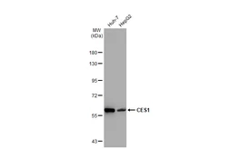Anti-CES1 antibody [GT1271] used in Western Blot (WB). GTX03183