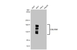 Anti-COL17A1 antibody [GT1273] used in Western Blot (WB). GTX03185