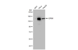 Anti-CPS1 antibody [GT1274] used in Western Blot (WB). GTX03186