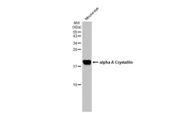 Anti-alpha A Crystallin antibody [GT1276] used in Western Blot (WB). GTX03188