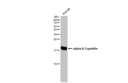 Anti-alpha A Crystallin antibody [GT1276] used in Western Blot (WB). GTX03188