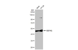 Anti-EEF1G antibody [GT1278] used in Western Blot (WB). GTX03190