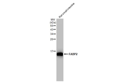 Anti-FABP2 antibody [GT1280] used in Western Blot (WB). GTX03192