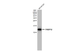 Anti-FKBP12 antibody [GT1281] used in Western Blot (WB). GTX03193