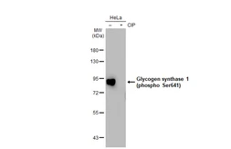 Anti-Glycogen synthase 1 (phospho Ser641) antibody [GT1284] used in Western Blot (WB). GTX03196
