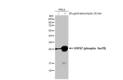 Anti-HSP27 (phospho Ser78) antibody [GT1285] used in Western Blot (WB). GTX03197