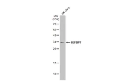 Anti-IGFBP7 antibody [GT1286] used in Western Blot (WB). GTX03198