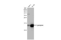 Anti-Lysozyme antibody [GT1290] used in Western Blot (WB). GTX03202